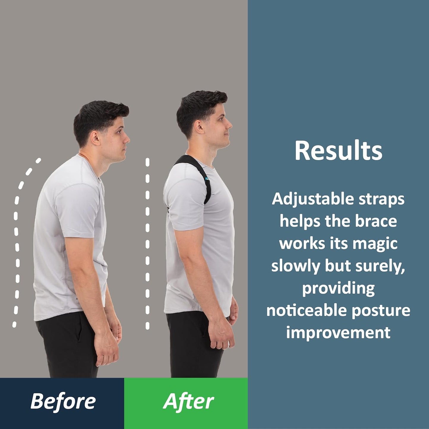 ComfyBrace Adjustable Posture Corrector – Breathable Back & Spine Support for Pain Relief
