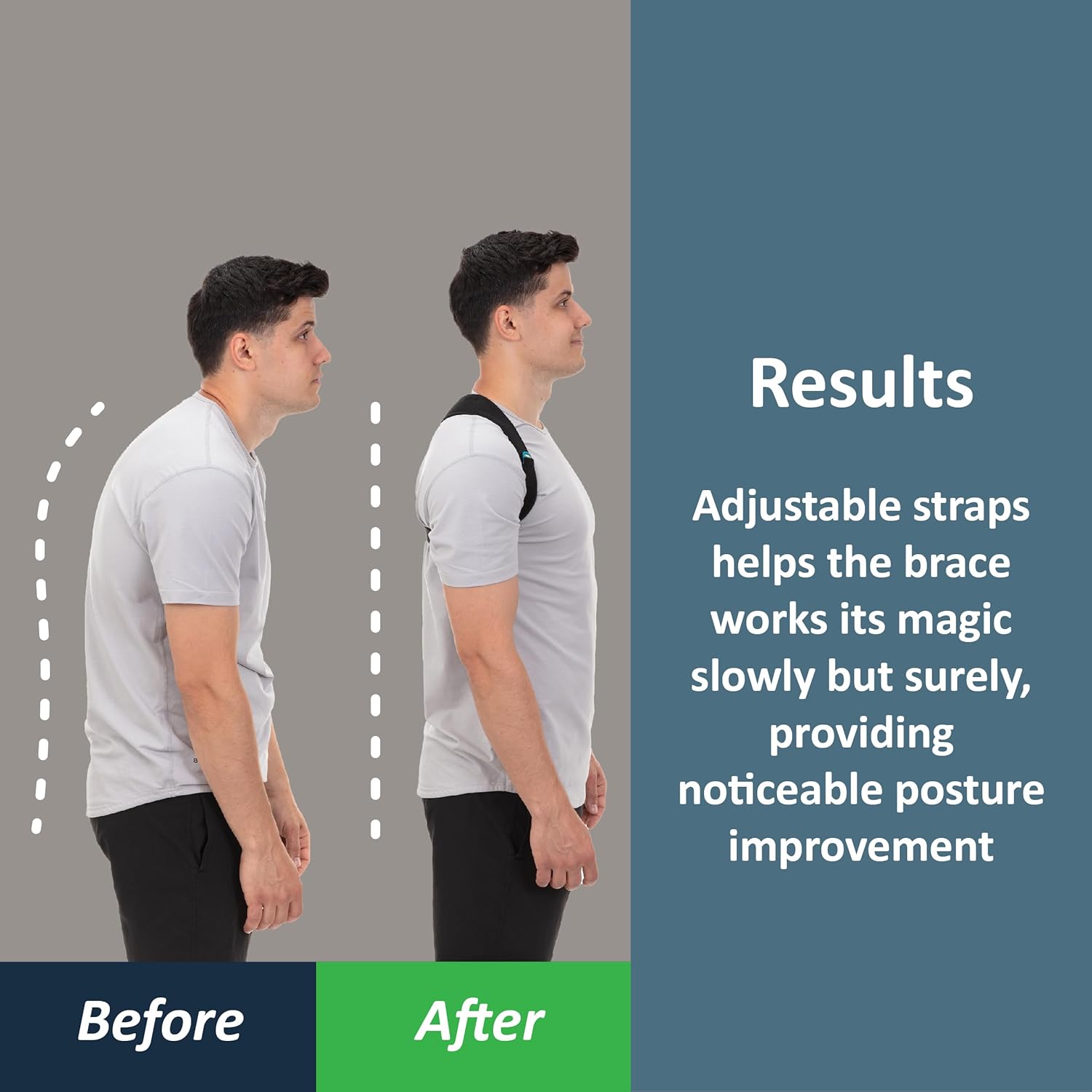 ComfyBrace Adjustable Posture Corrector – Breathable Back & Spine Support for Pain Relief
